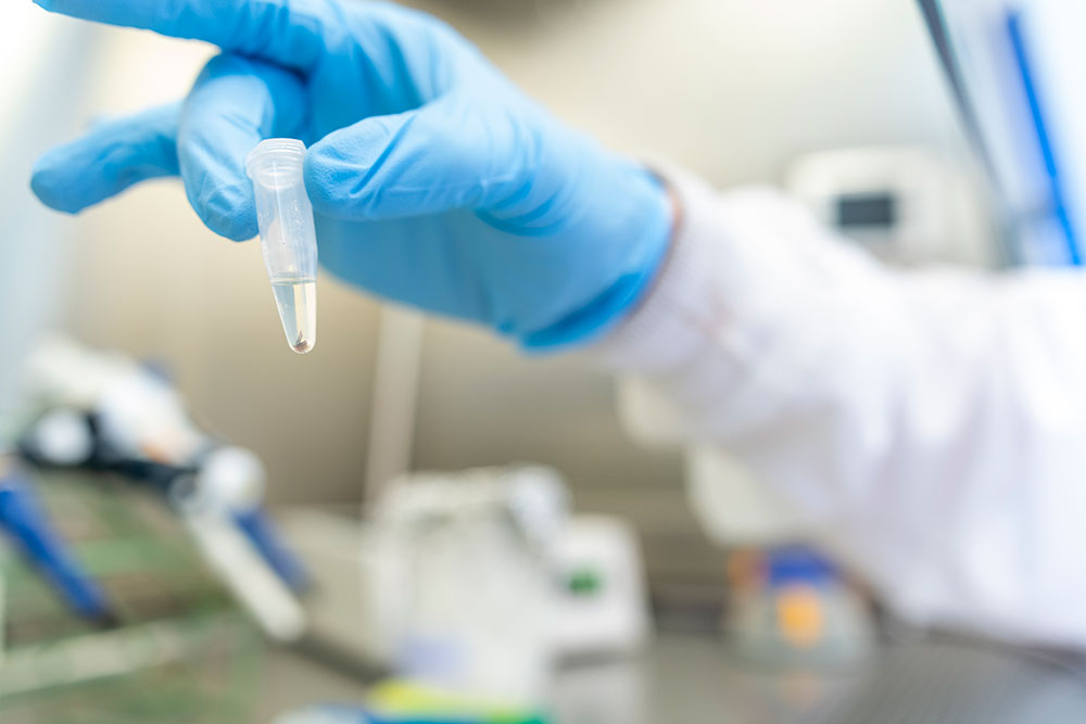 A Western Black legged Tick. As part of the research, Zhong and his students are analyzing tick DNA, and blood from mammals to detect the bacteria’s presence. 